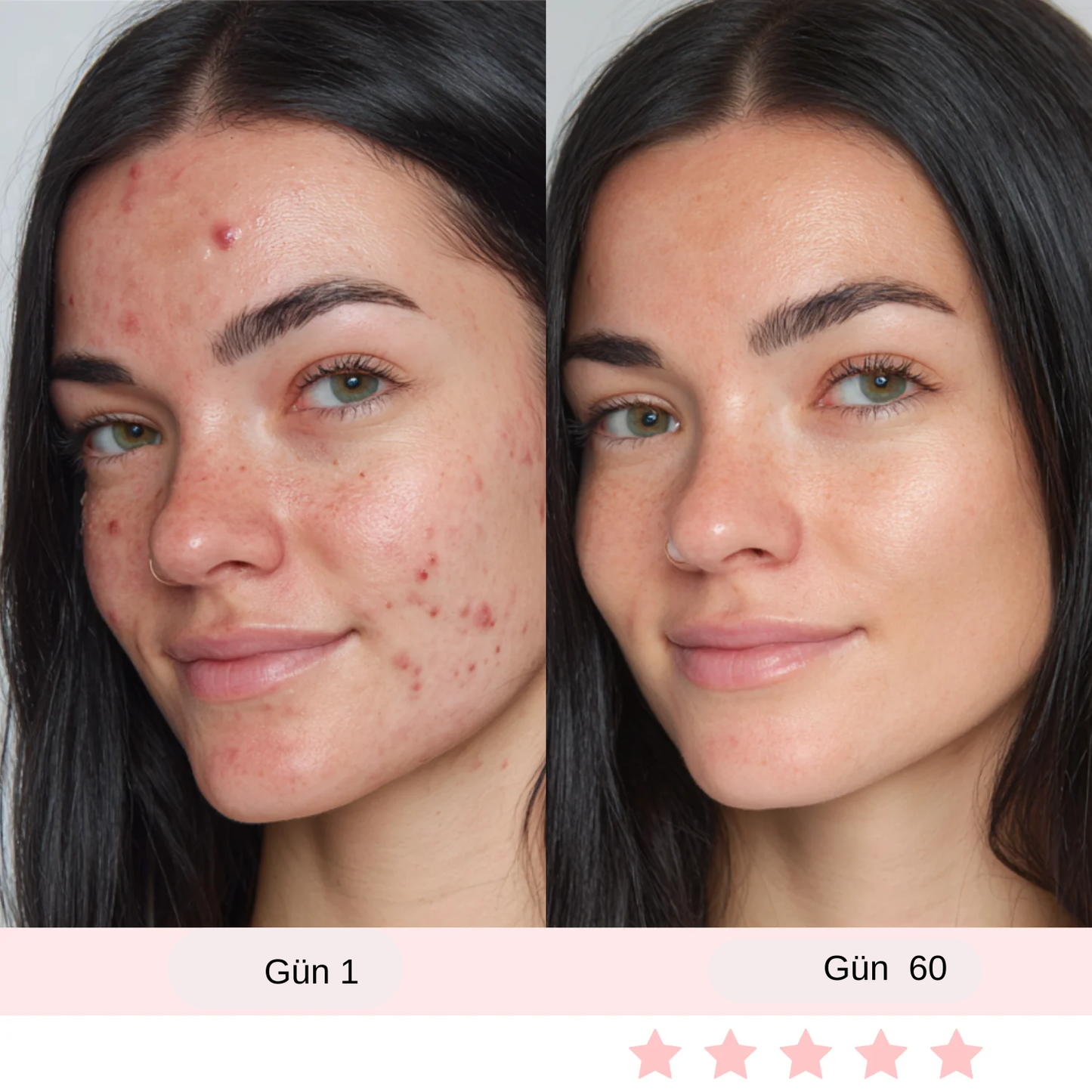 Yüz ve Boyun kırışıklık giderici