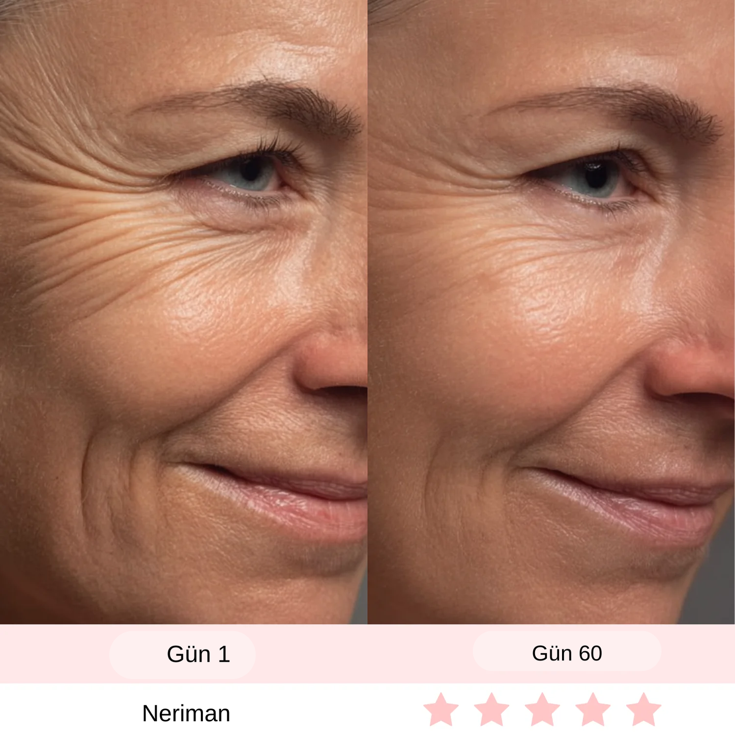 Yüz ve Boyun kırışıklık giderici